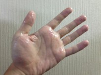 手汗で悩んでいる方へ、手掌多汗症の僕が実施している対策とアドバイス